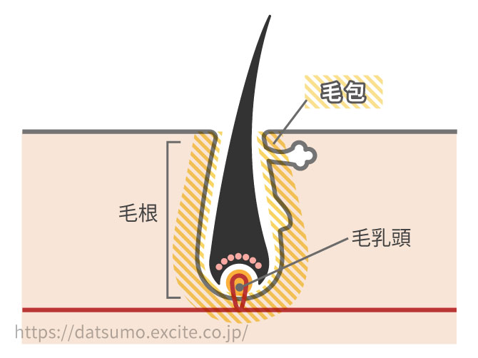 IPL脱毛って?