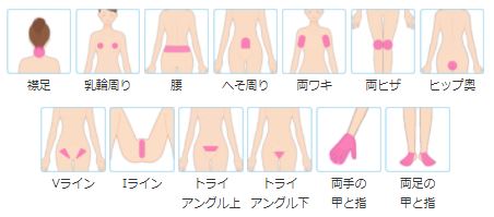 ミュゼプラチナムーフリーセレクトコースS