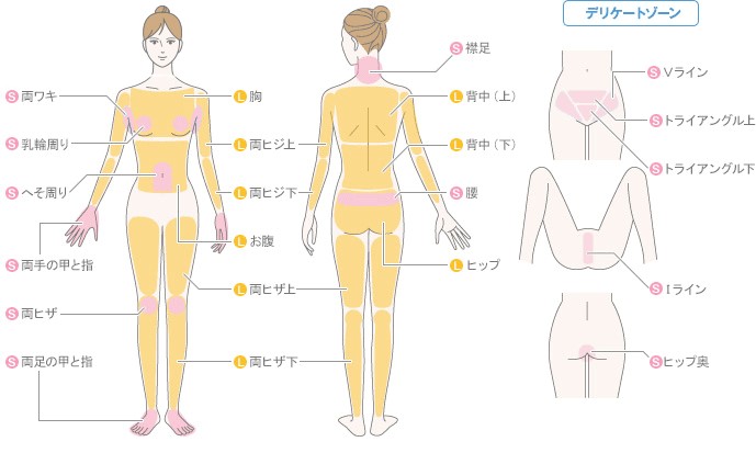 ミュゼプラチナムー脱毛可能箇所