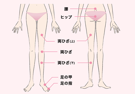 キレイモ脱毛部位:下半身