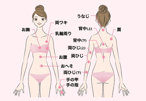 キレイモ脱毛部位:上半身