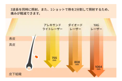 アリシアクリニック_レーザー波長_ラシャ トリニティプロ